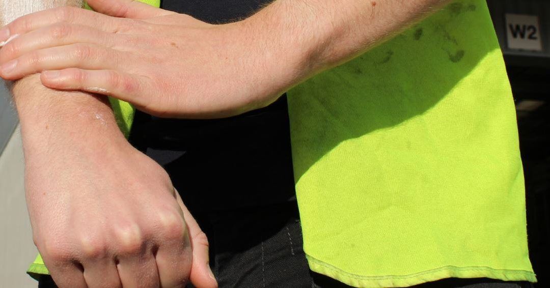 PROTECTOR SOLAR PARA PROFESIONALES: LA PREVENCIÓN LO ES TODO